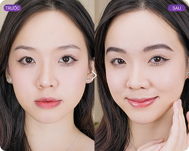 Kết quả phun môi 2