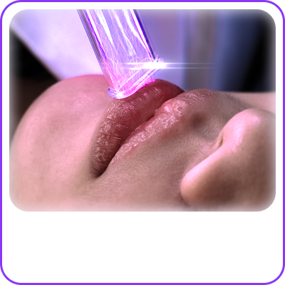 Plasma môi