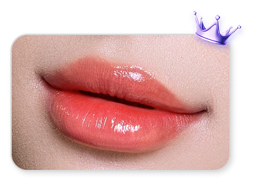 Cấy môi Diamond Lips