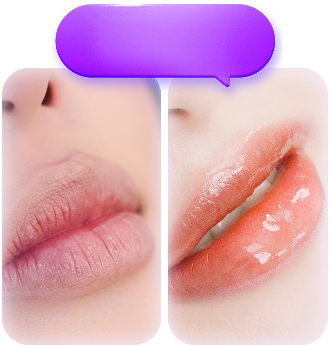 Phun môi collagen cải thiện môi khô nứt nẻ