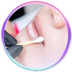 Vệ sinh và sát khuẩn trước khi phun môi collagen