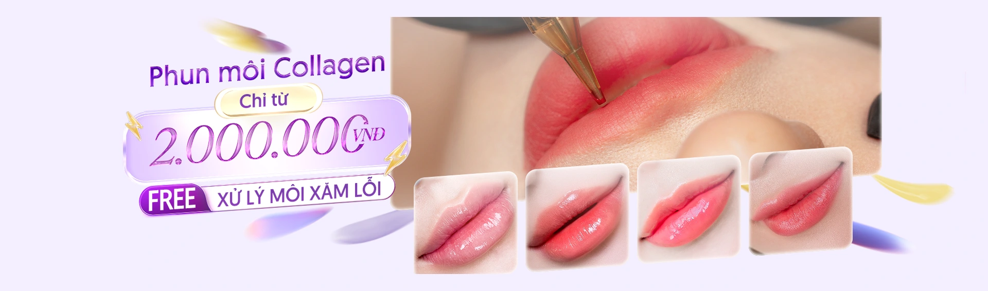 Khuyến mãi phun môi collagen chỉ từ 2 triệu đồng tại Linh Anh