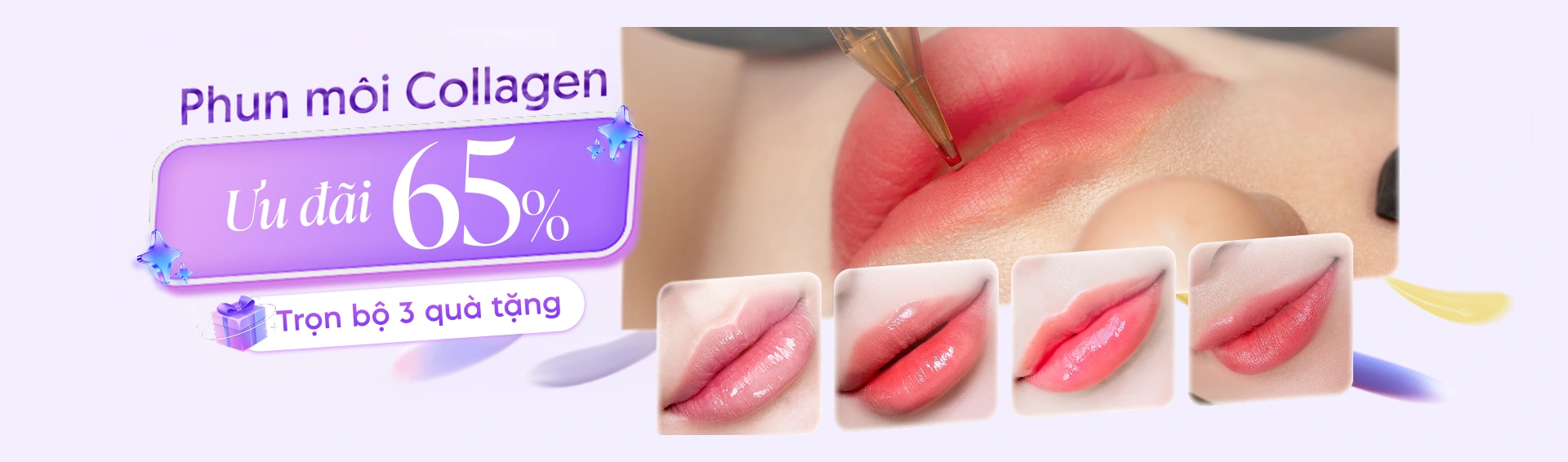 Khuyến mãi phun môi collagen chỉ từ 2 triệu đồng tại Linh Anh