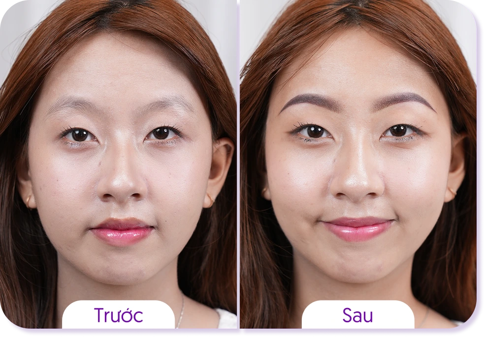 Kết quả khách hàng phun mày tại Linh Anh trước và sau