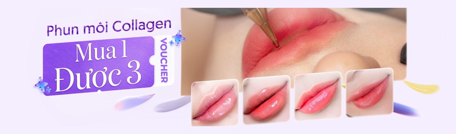 Khuyến mãi phun môi collagen chỉ từ 2 triệu đồng tại Linh Anh