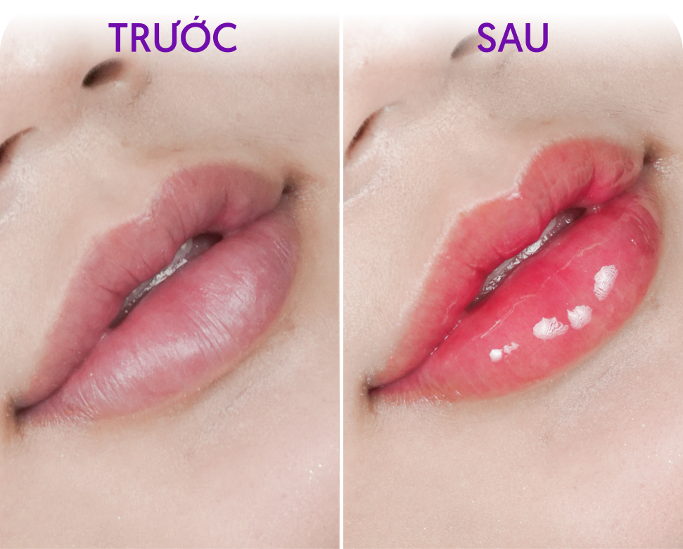 Trước và sau Phun môi Personal 4K Colors – Khách hàng Minh Ngọc