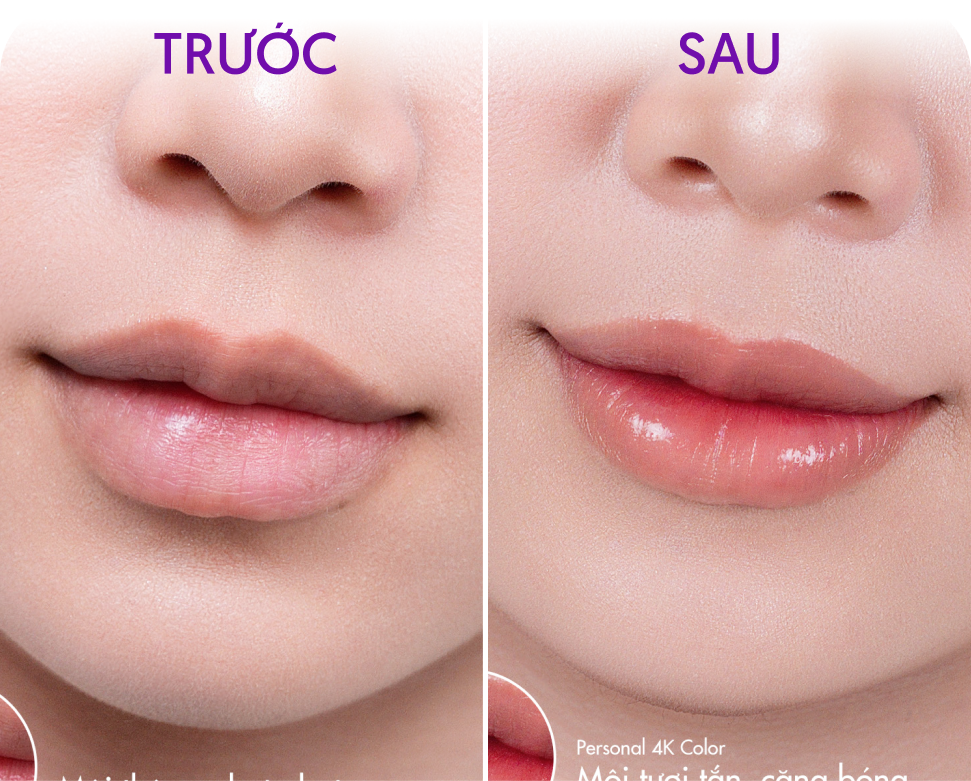 Trước và sau Phun môi Personal 4K Colors – Khách hàng Thu Thảo