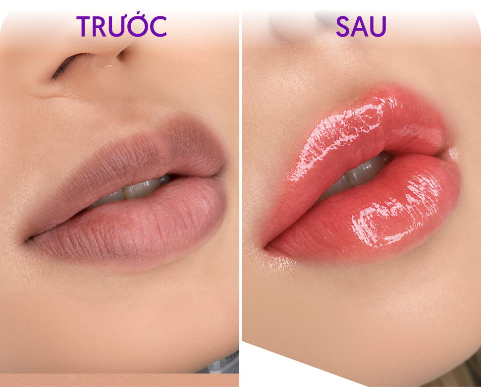 Trước và sau Phun môi Diamond Lips – Khách hàng Minh Thư
