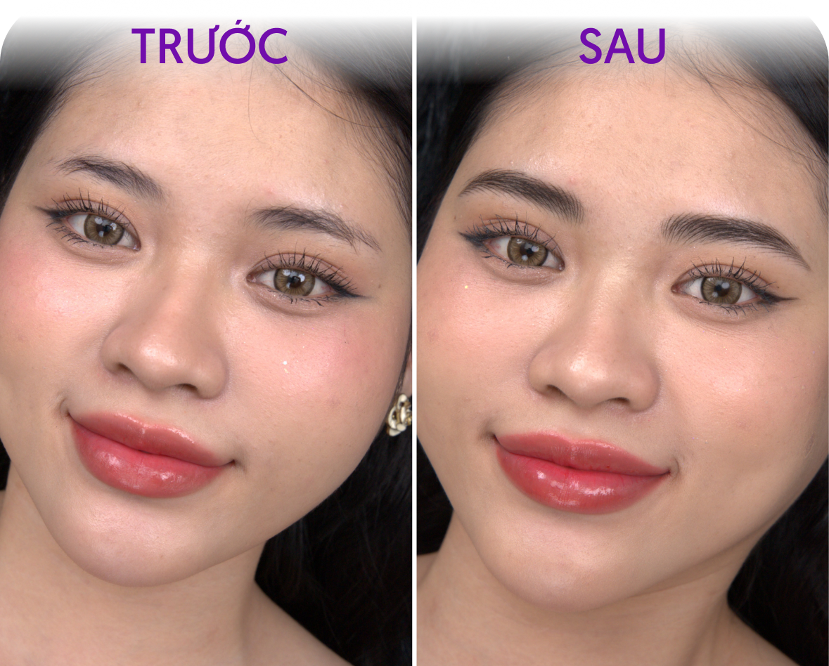 Trước và sau phun mày – Khách hàng Kiều Trinh