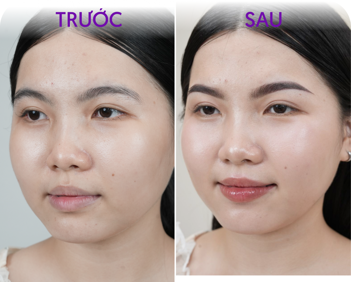 Trước và sau phun mày – Khách hàng Tú Uyên