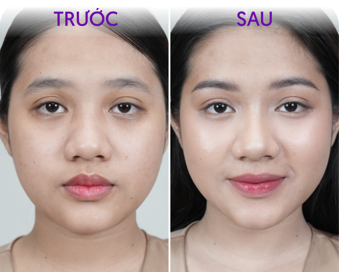 Trước và sau phun mày – Khách hàng Kim Hằng