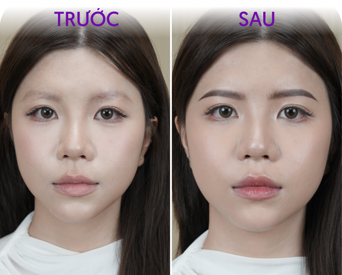 Trước và sau phun mày – Khách hàng Tuyết Cầm