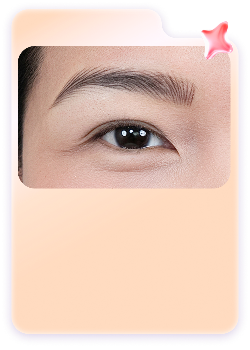 Hairstroke siêu sợi tại Linh Anh
