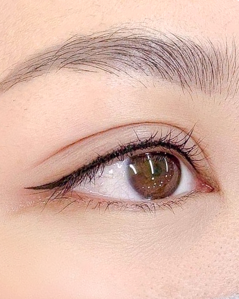 Mắt hai mí tại Thẩm mỹ Linh Anh