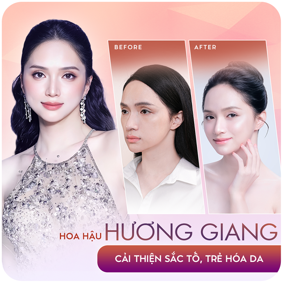 Hoa hậu Hương Giang – Cải thiện sắc tố, trẻ hóa da – Sao Việt đồng hành cùng Thẩm mỹ Linh Anh