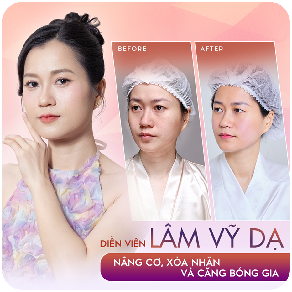 Diễn viên Lâm Vỹ Dạ – Thẩm mỹ công nghệ cao – Sao Việt đồng hành cùng Thẩm mỹ Linh Anh