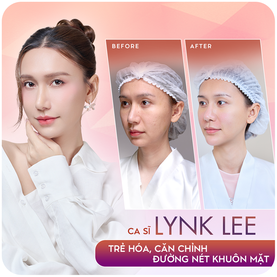Sao Việt làm đẹp Thẩm mỹ công nghệ cao tại Thẩm mỹ Linh Anh – hình 3