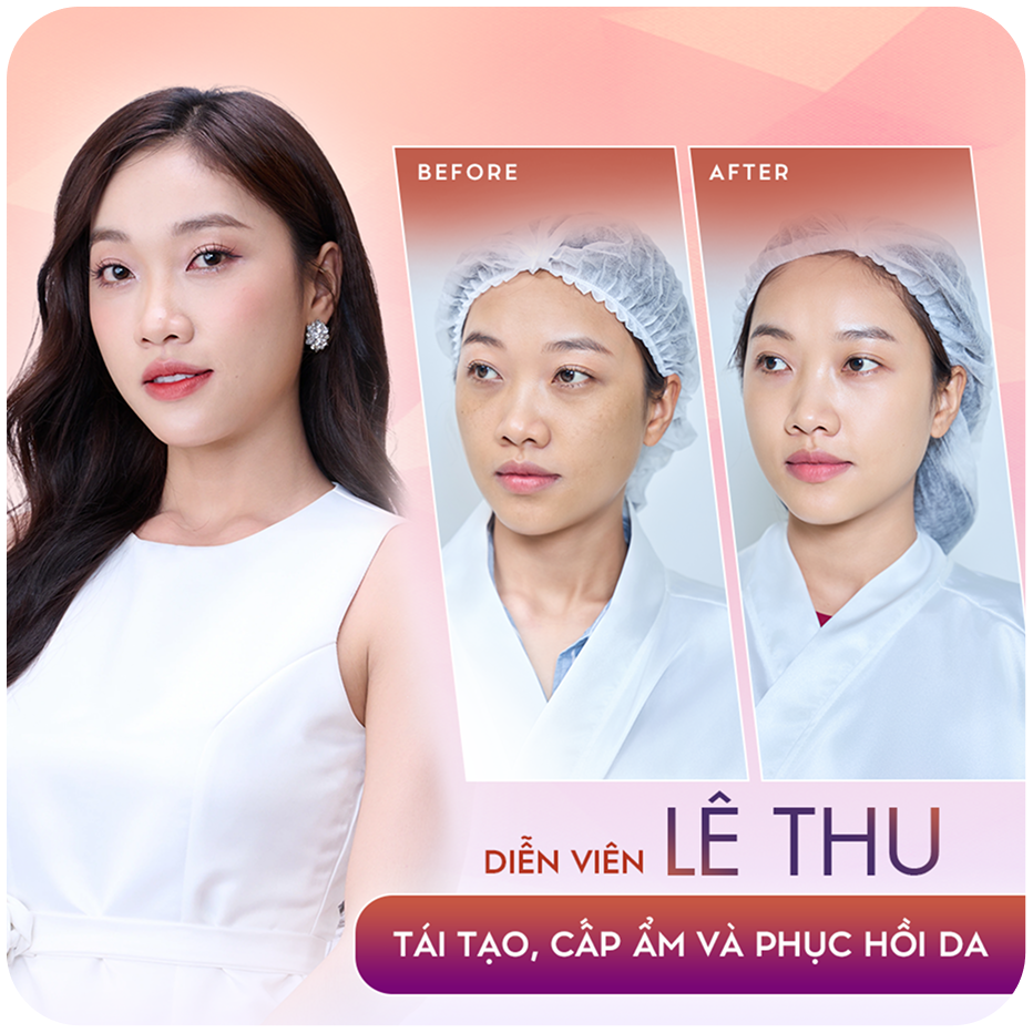 Sao Việt làm đẹp Thẩm mỹ công nghệ cao tại Thẩm mỹ Linh Anh – hình 4