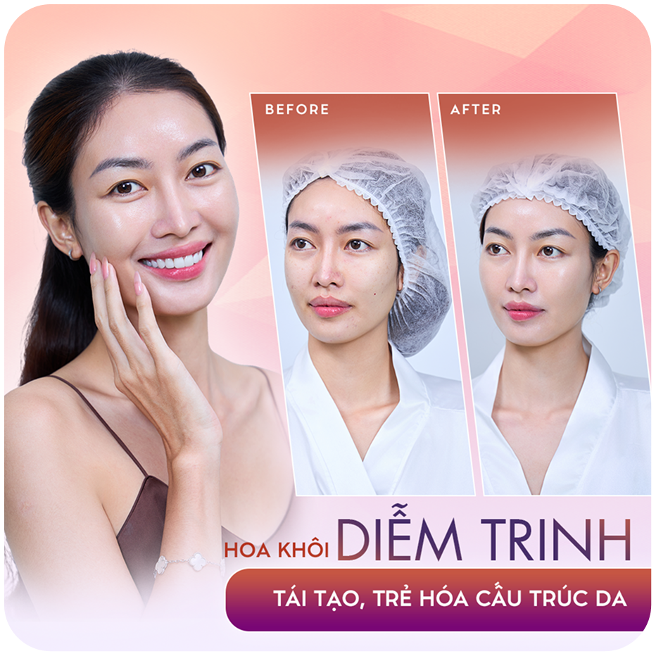 Sao Việt làm đẹp Thẩm mỹ công nghệ cao tại Thẩm mỹ Linh Anh – hình 5