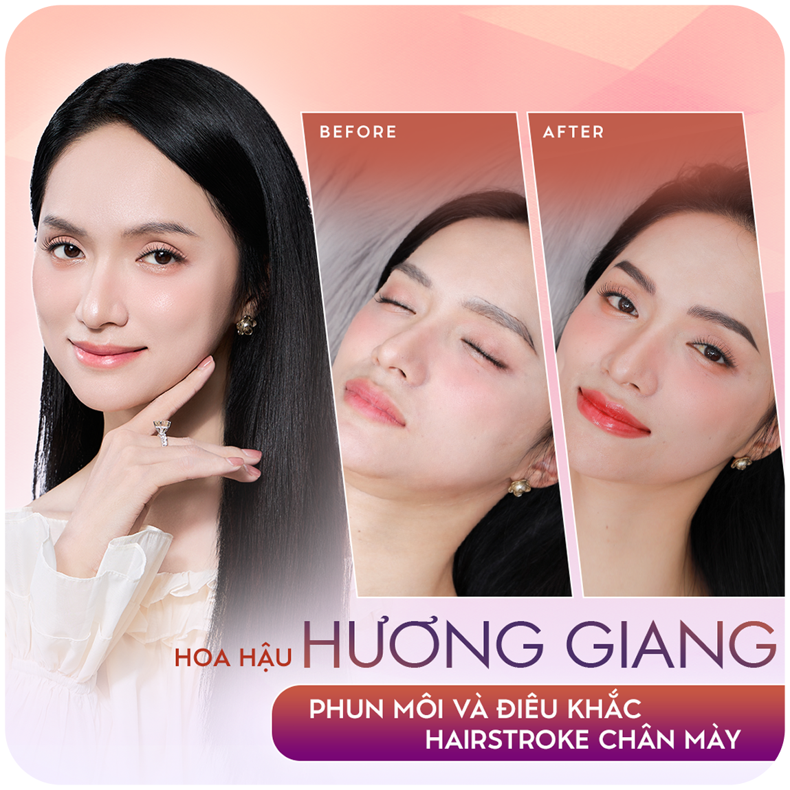 Hoa hậu Hương Giang – Phun môi và điêu khắc Hairstroke chân mày – Sao Việt đồng hành cùng Thẩm mỹ Linh Anh
