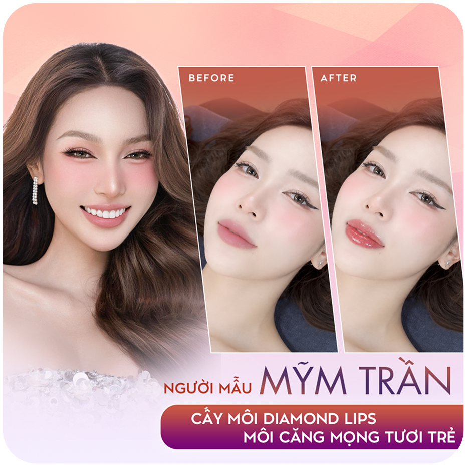 Sao Việt làm đẹp Phun xăm thẩm mỹ tại Thẩm mỹ Linh Anh – hình 3