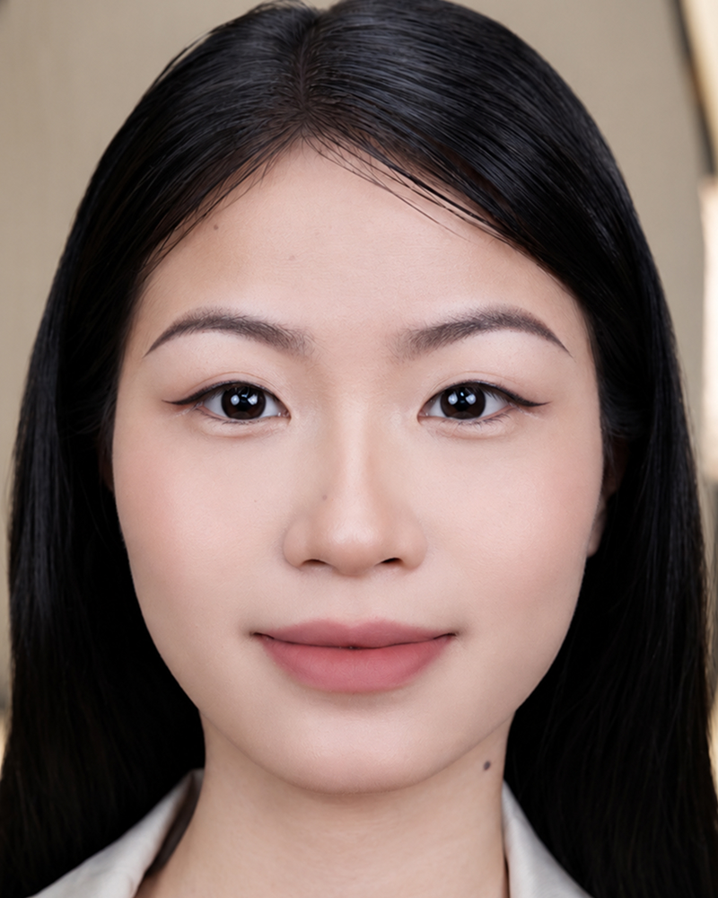 Khách hàng Mai Anh – ảnh sau Phun mí tại Thẩm mỹ Linh Anh