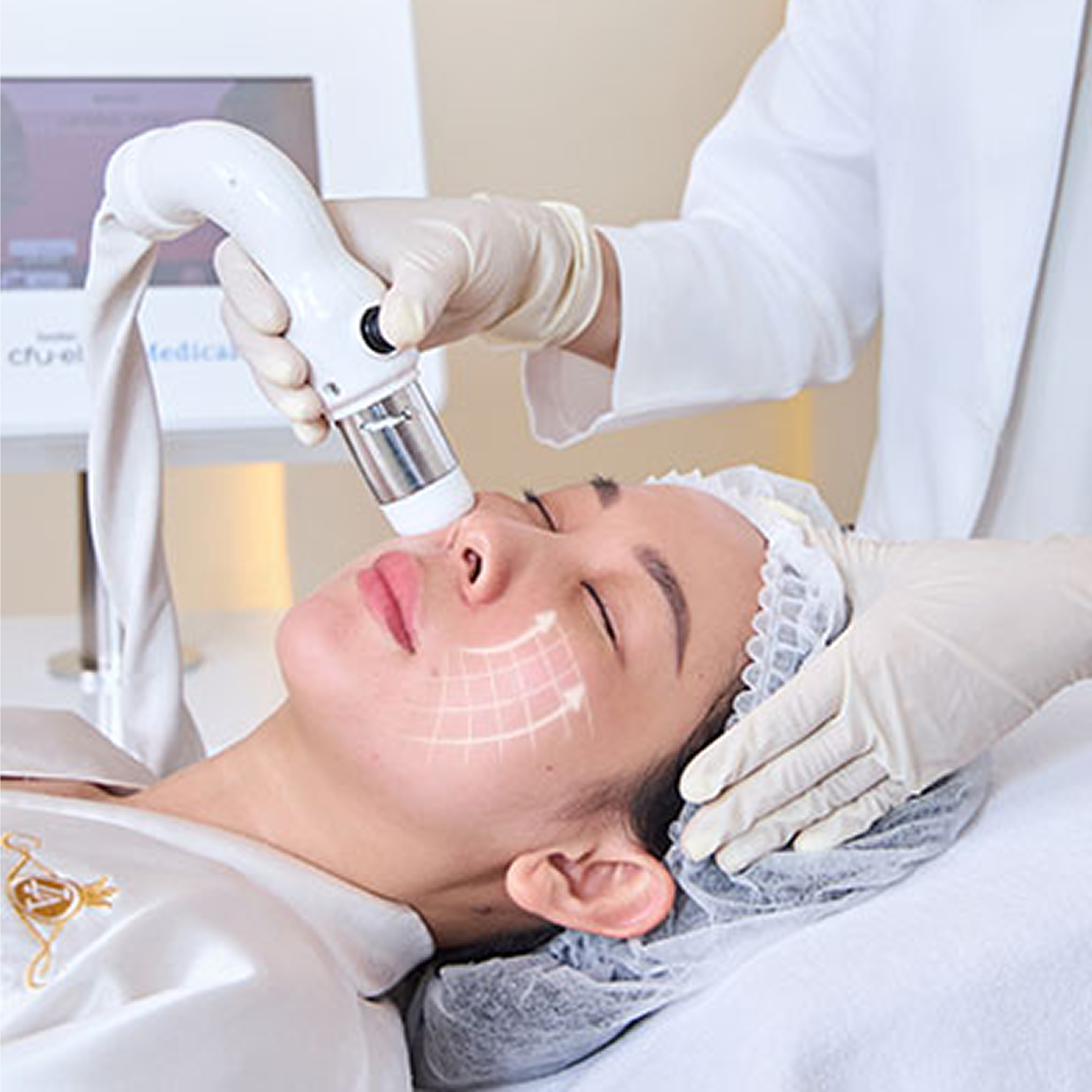 CFU ÈLIFE tại Thẩm mỹ Linh Anh