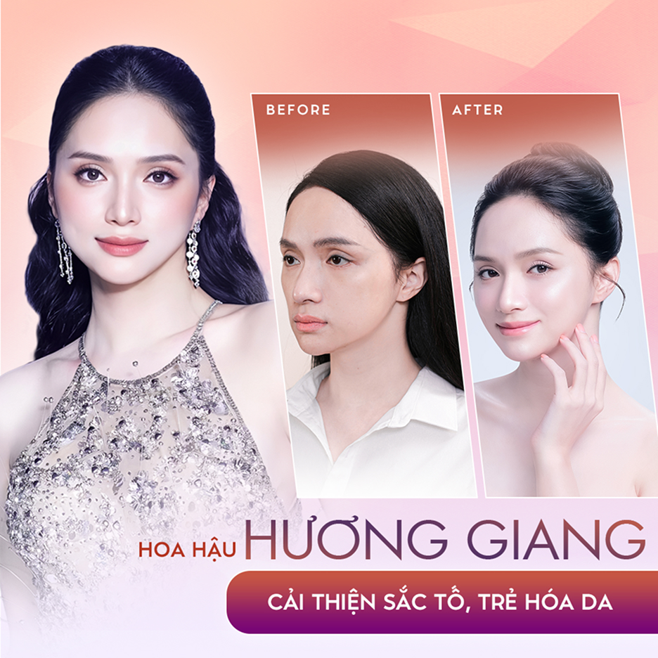 Hoa hậu Hương Giang – Liệu trình trẻ hóa, cải thiện sắc tố da tại Thẩm mỹ Linh Anh (ảnh trước và sau)