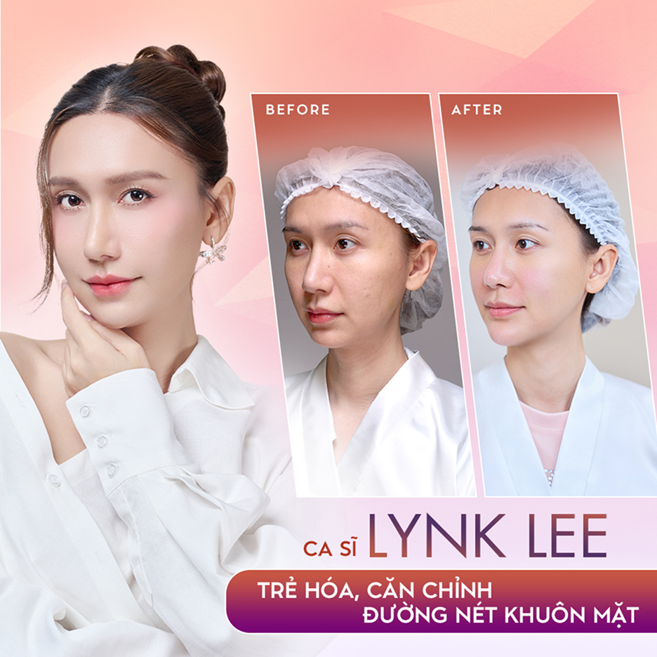 Ca sĩ Lynk Lee – Trẻ hóa, cân chỉnh đường nét gương mặt tại Thẩm mỹ Linh Anh (ảnh trước và sau)