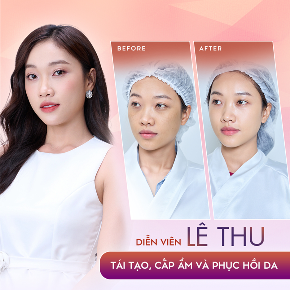 Diễn viên Lê Thu – Tái tạo, phục hồi cấu trúc da tại Thẩm mỹ Linh Anh (ảnh trước và sau)