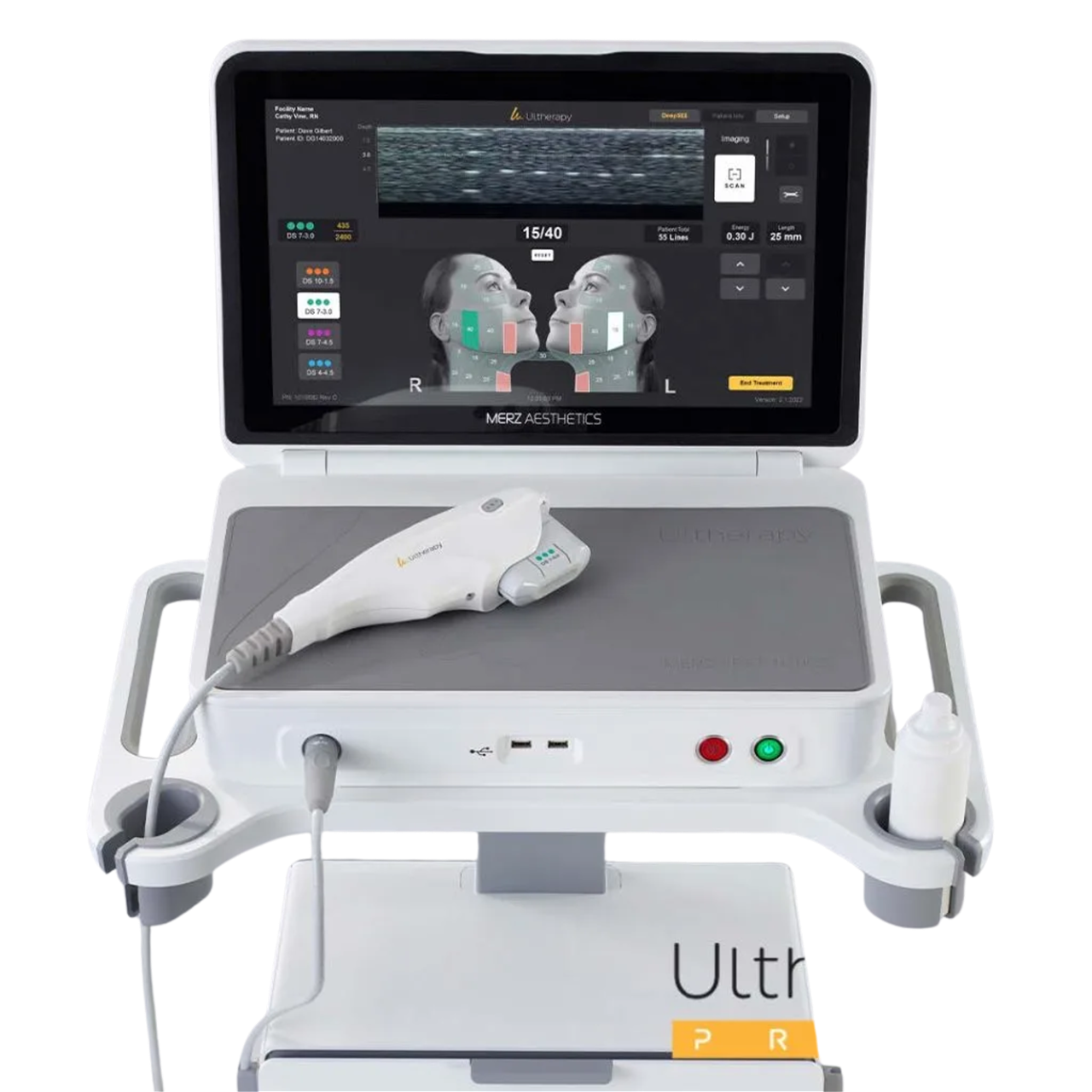 Ultherapy Prime tại Thẩm mỹ Linh Anh